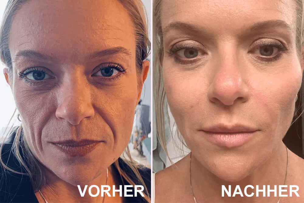 ✨ V-Face Lifting Tape – Sofortiger Lift-Effekt & straffere Konturen