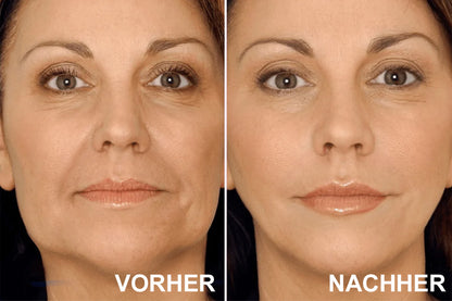 ✨ V-Face Lifting Tape – Sofortiger Lift-Effekt & straffere Konturen