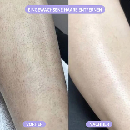 ✨🔥2-in-1 Schmerzfreier Bikini Trimmer für Gesicht & Körper