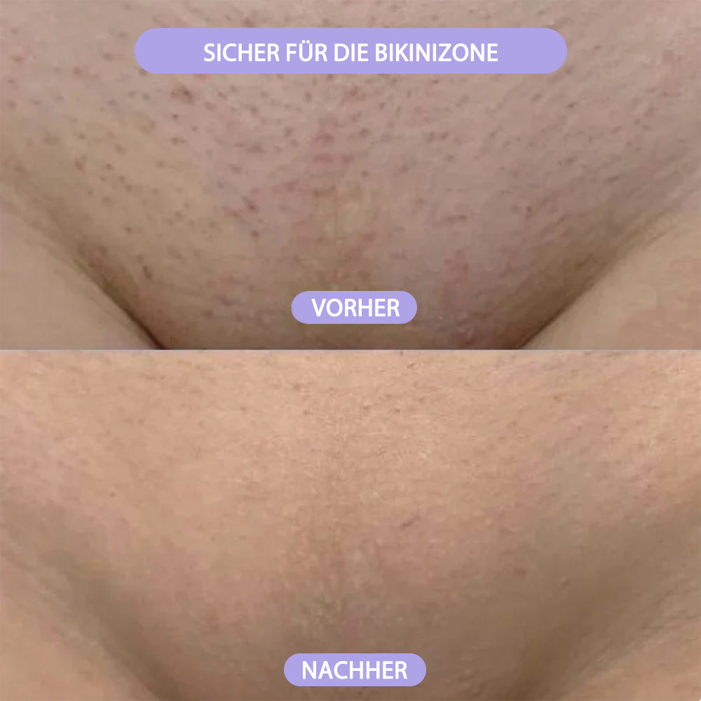 🆙✨2-in-1 Schmerzfreier Bikini Trimmer für Gesicht & Körper