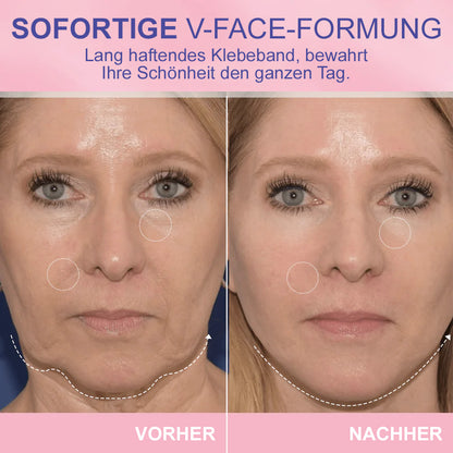 ✨ V-Face Lifting Tape – Sofortiger Lift-Effekt & straffere Konturen