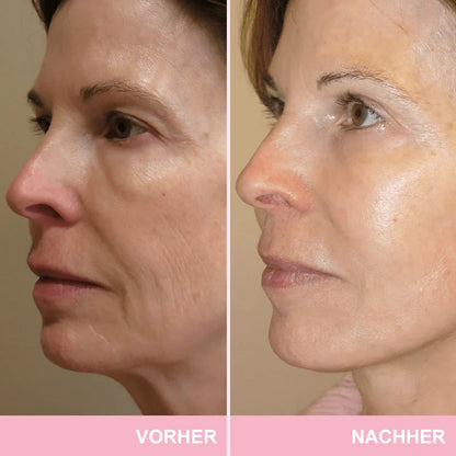 ✨ V-Face Lifting Tape – Sofortiger Lift-Effekt & straffere Konturen