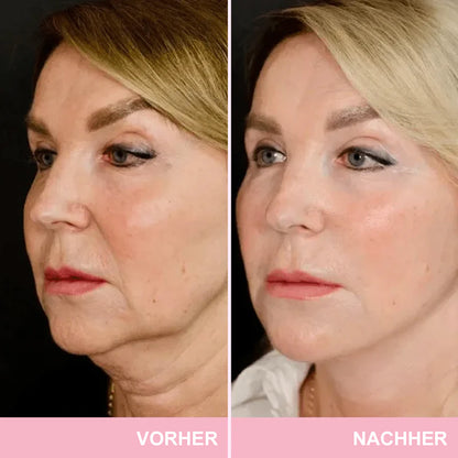 ✨ V-Face Lifting Tape – Sofortiger Lift-Effekt & straffere Konturen