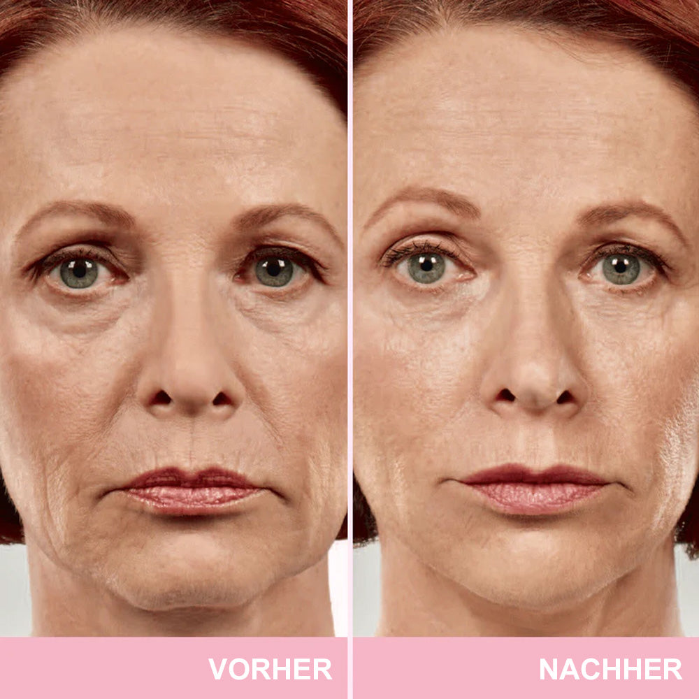 ✨ V-Face Lifting Tape – Sofortiger Lift-Effekt & straffere Konturen