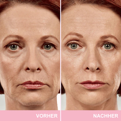 ✨ V-Face Lifting Tape – Sofortiger Lift-Effekt & straffere Konturen