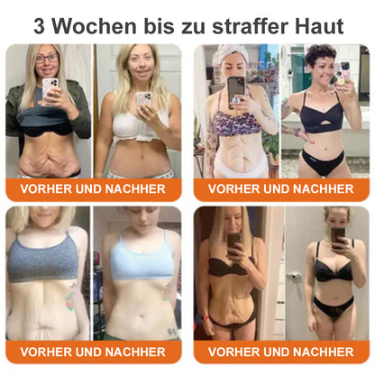 🐝Tinuos® Straffende Burn Gold Massagecreme