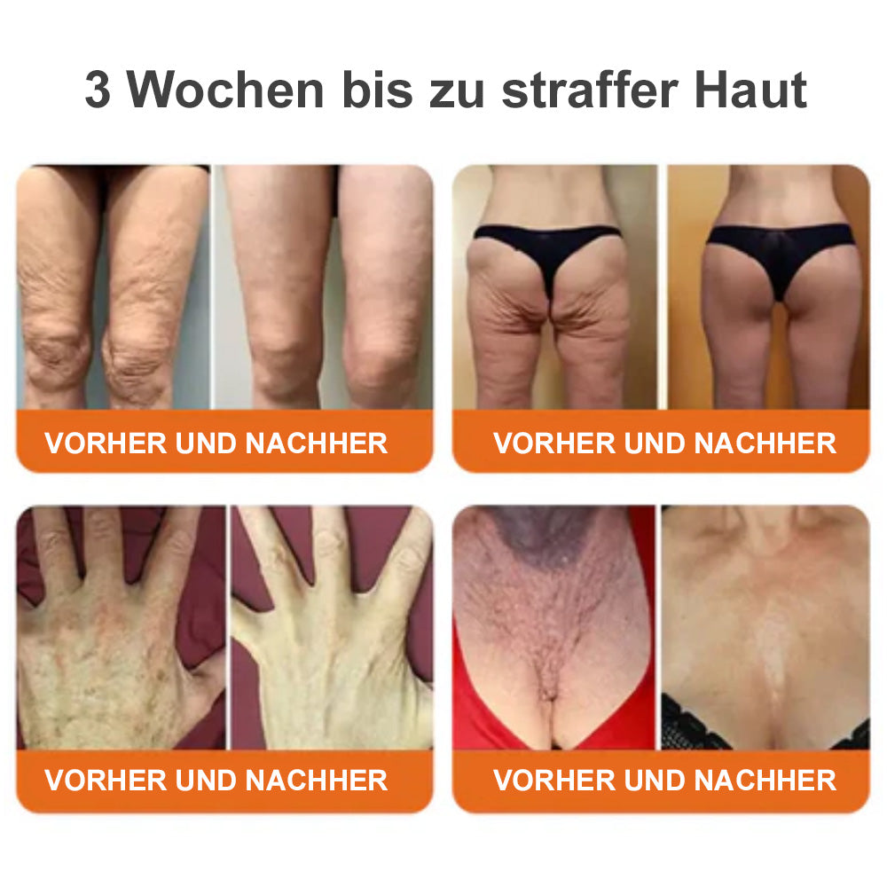 🐝Tinuos® Straffende Burn Gold Massagecreme