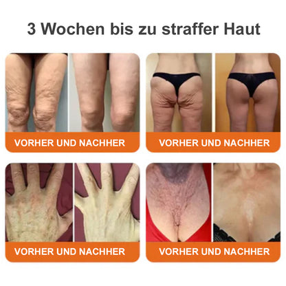 🐝Tinuos® Straffende Burn Gold Massagecreme