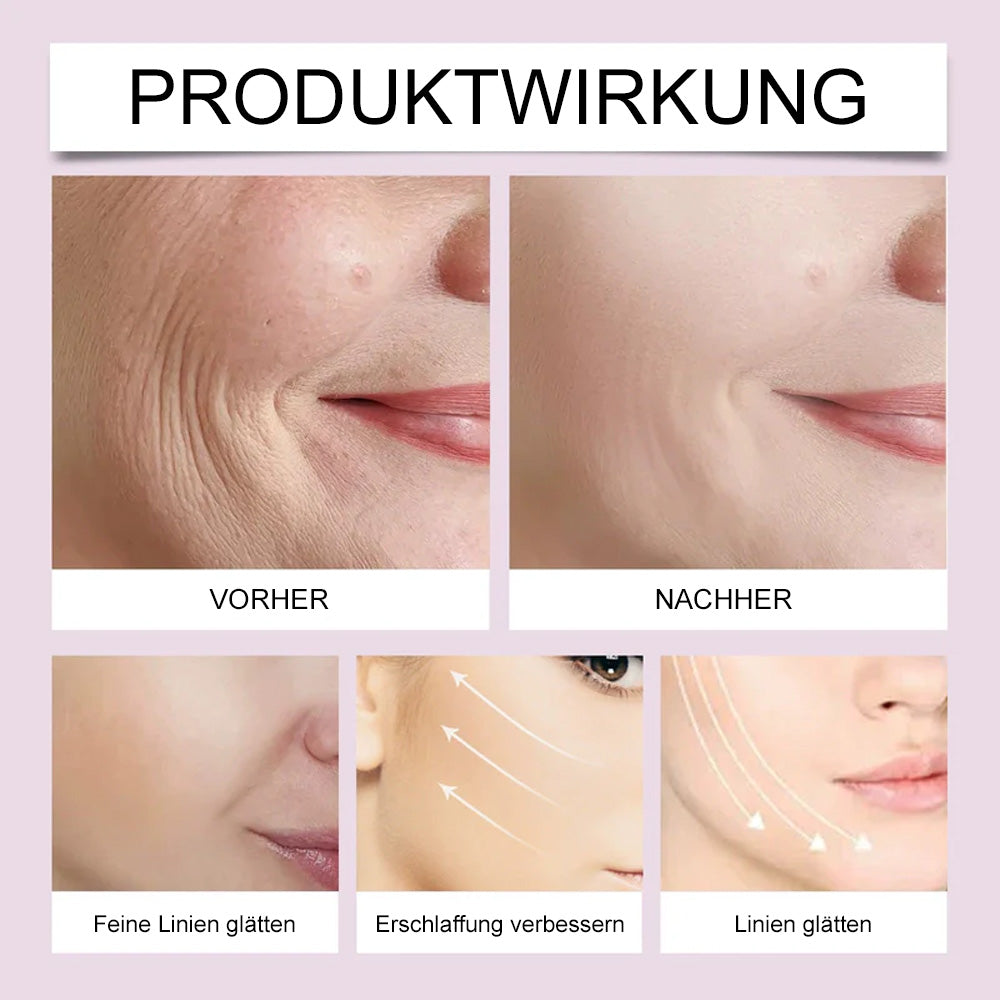 ✨ V-Face Lifting Tape – Sofortiger Lift-Effekt & straffere Konturen