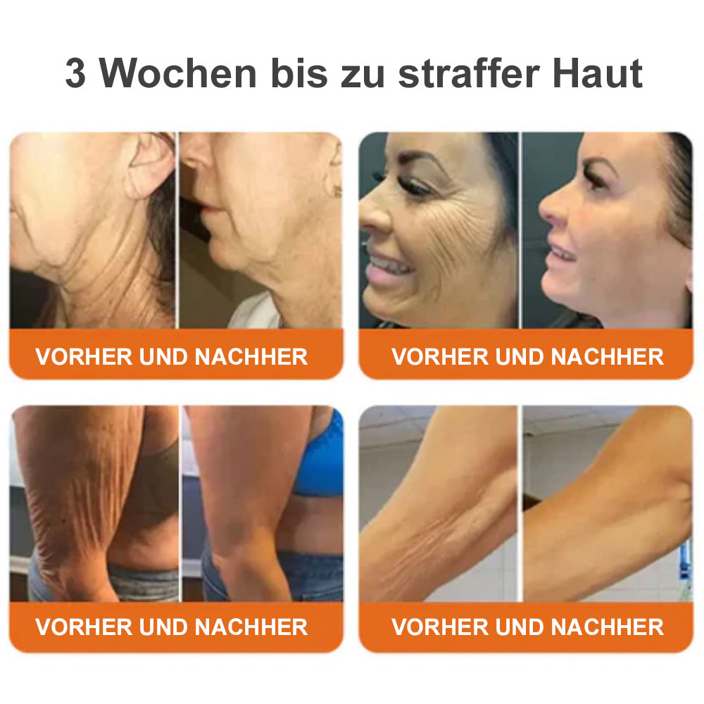 🐝Tinuos® Straffende Burn Gold Massagecreme