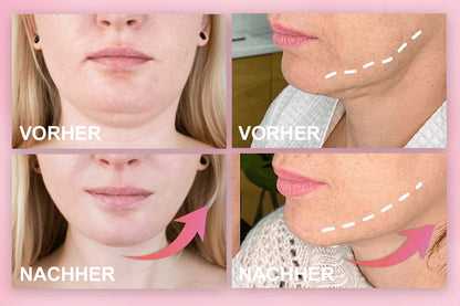 ✨ V-Face Lifting Tape – Sofortiger Lift-Effekt & straffere Konturen